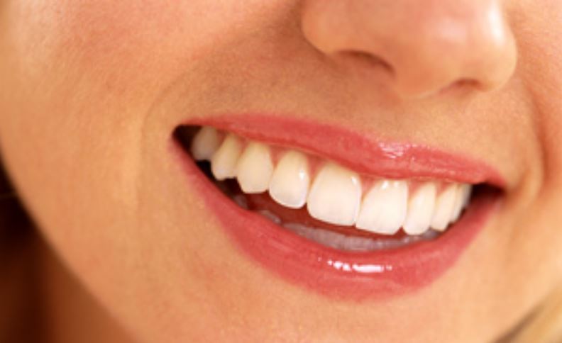 Abbotsford Teeth Whitening